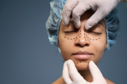Cirurgias Estéticas Orofaciais